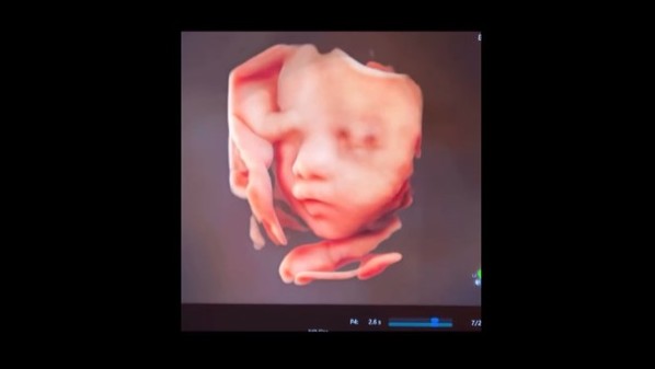 奇跡の瞬間を、より鮮明に💫